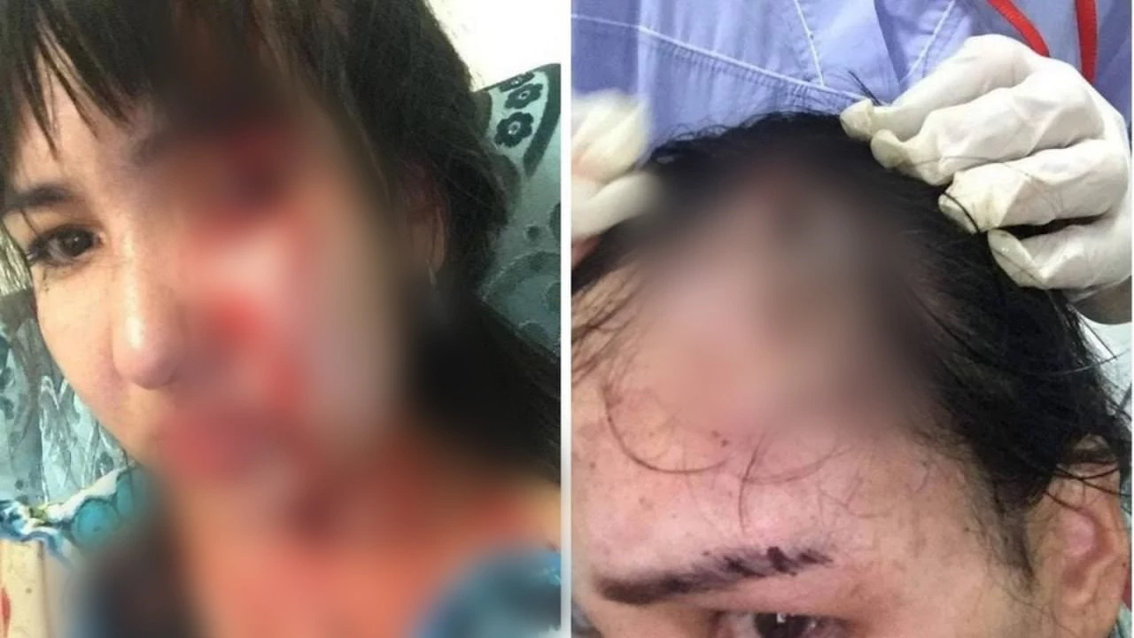 Жительница Атырау обвинила бывшего мужа-депутата в избиениях